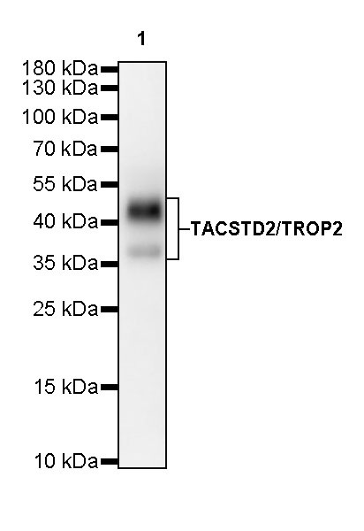 Rabbit anti-TACSTD2 Recombinant Monoclonal Antibody(S-R237)