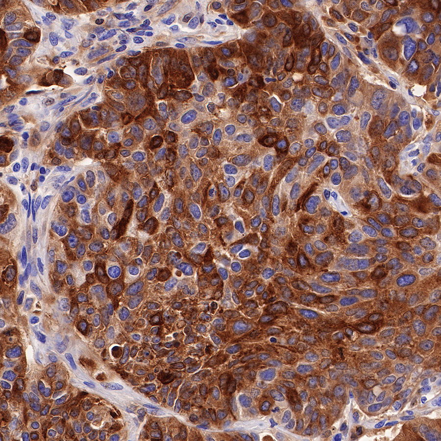 Rabbit anti-GPNMB Recombinant Monoclonal Antibody(S-R241)