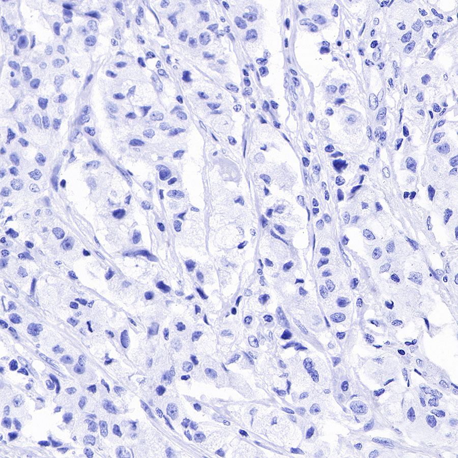 Rabbit anti-CA125 Recombinant Monoclonal Antibody(555-41)