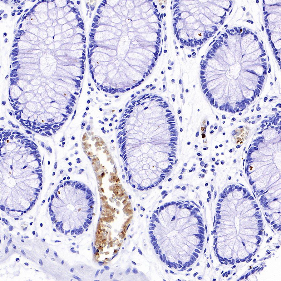 Rabbit anti-Hemoglobin α Recombinant Monoclonal Antibody(S-R242)