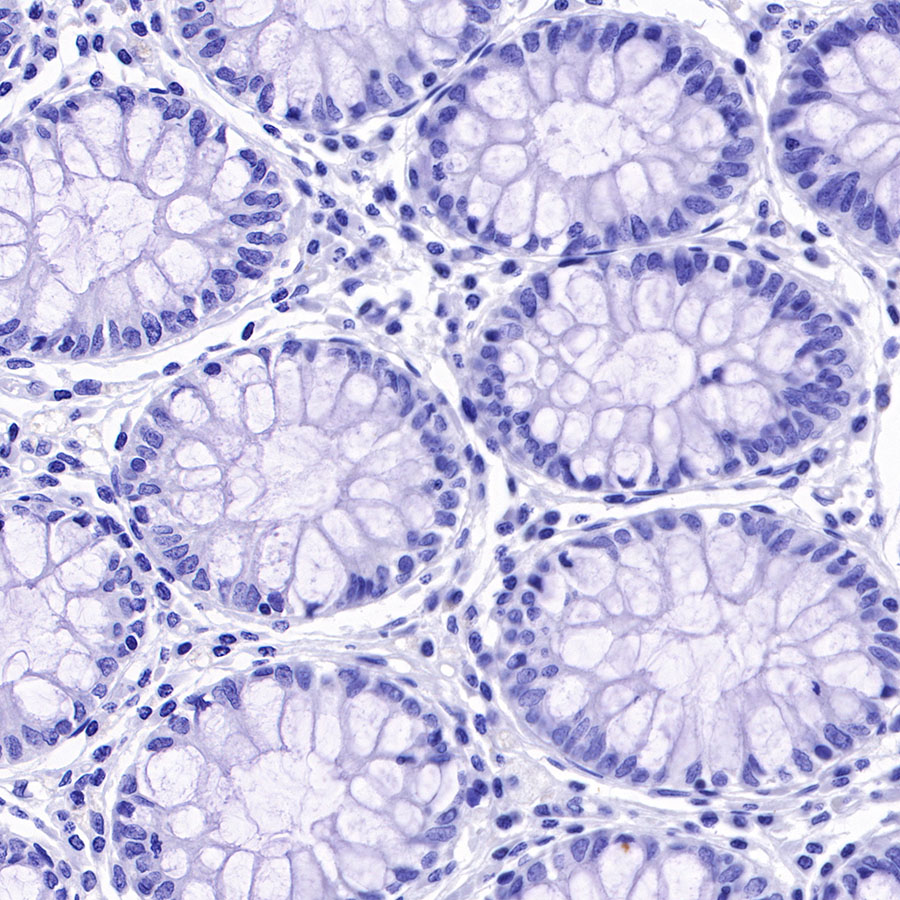 Rabbit anti-TACSTD2 Recombinant Monoclonal Antibody(S-R237)