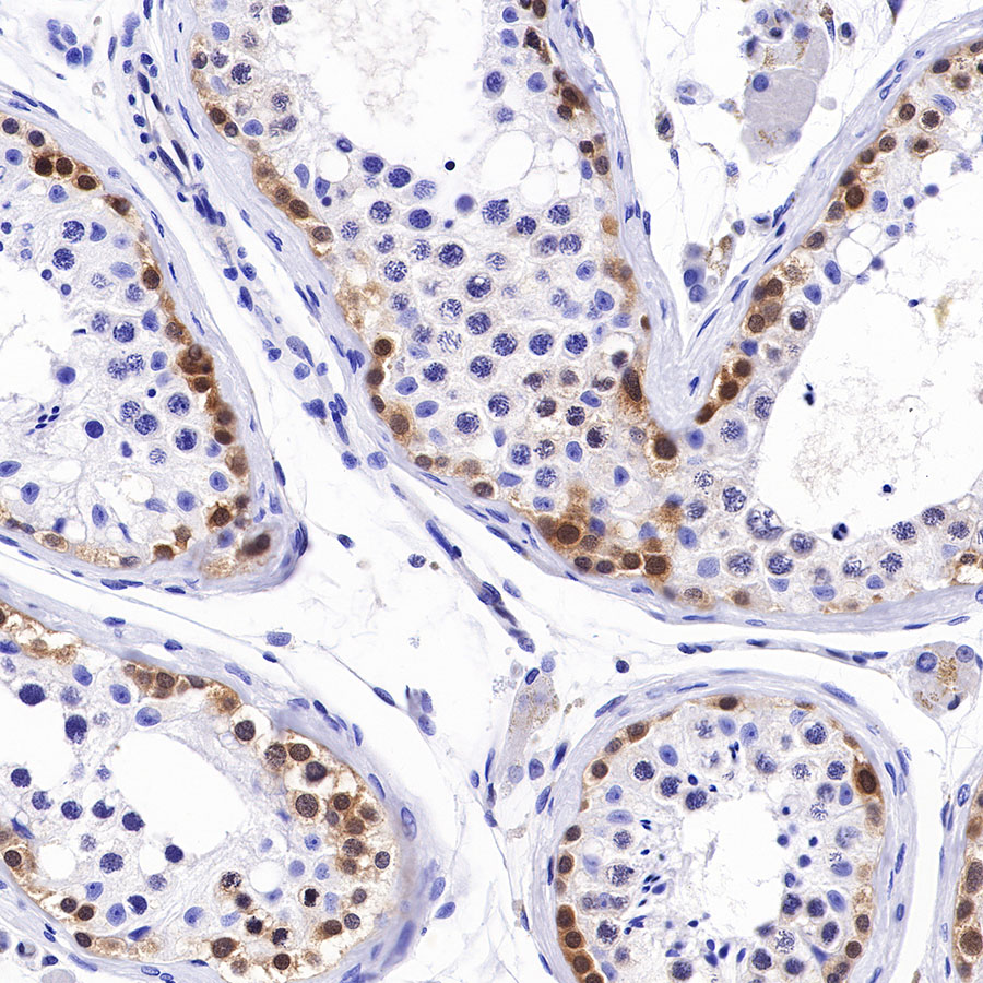 Rabbit anti-Caspase-7 Recombinant Monoclonal Antibody(S-R254)