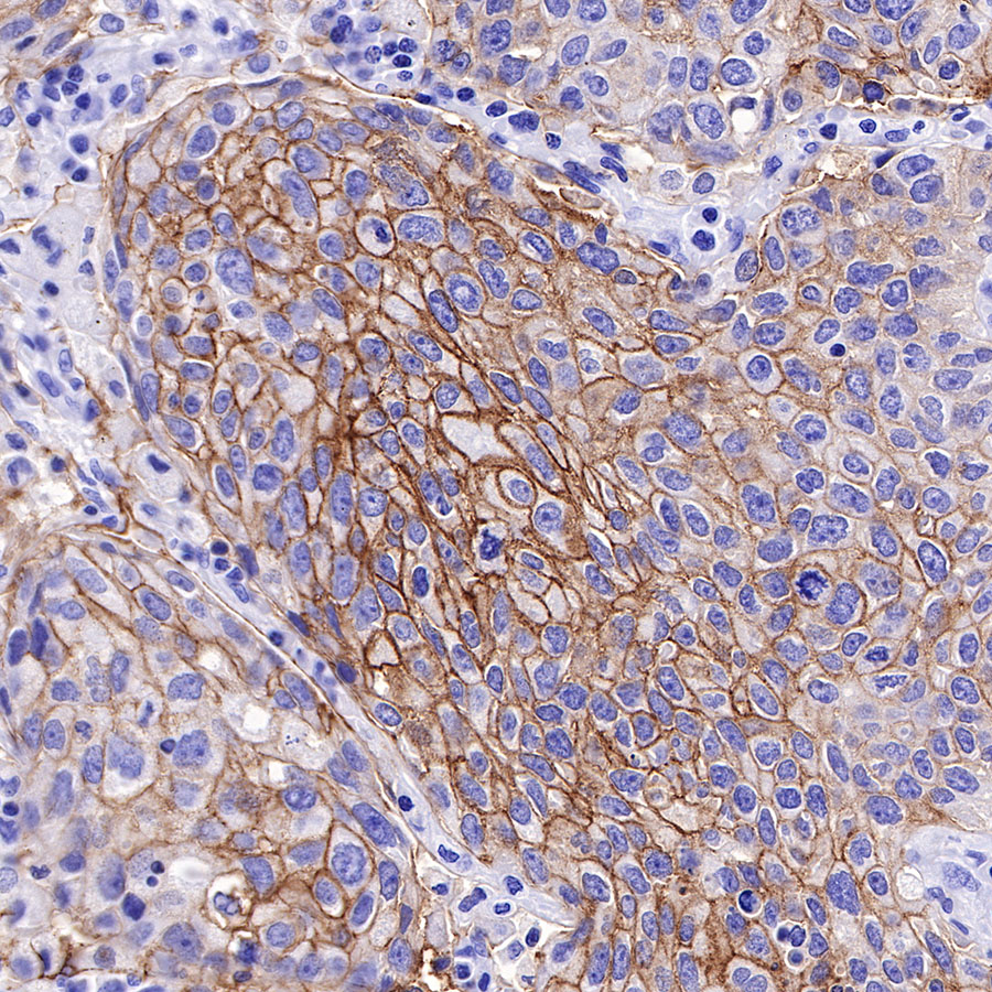Rabbit anti-TACSTD2 Recombinant Monoclonal Antibody(S-R237)
