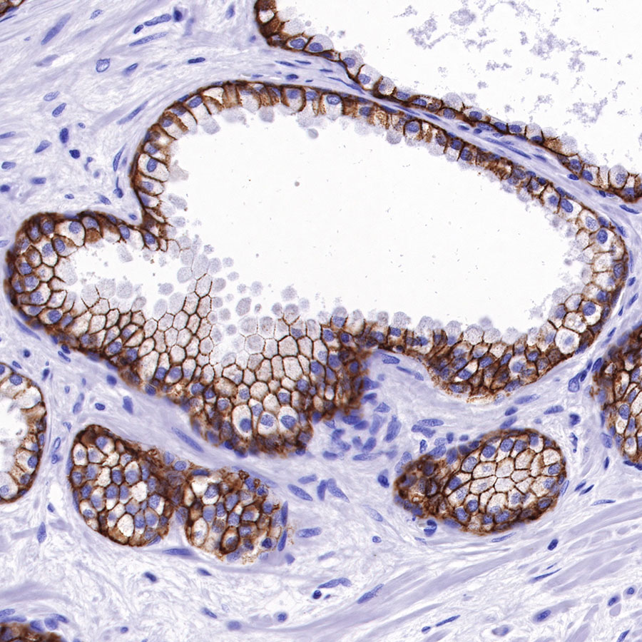 Rabbit anti-TACSTD2 Recombinant Monoclonal Antibody(S-R237)