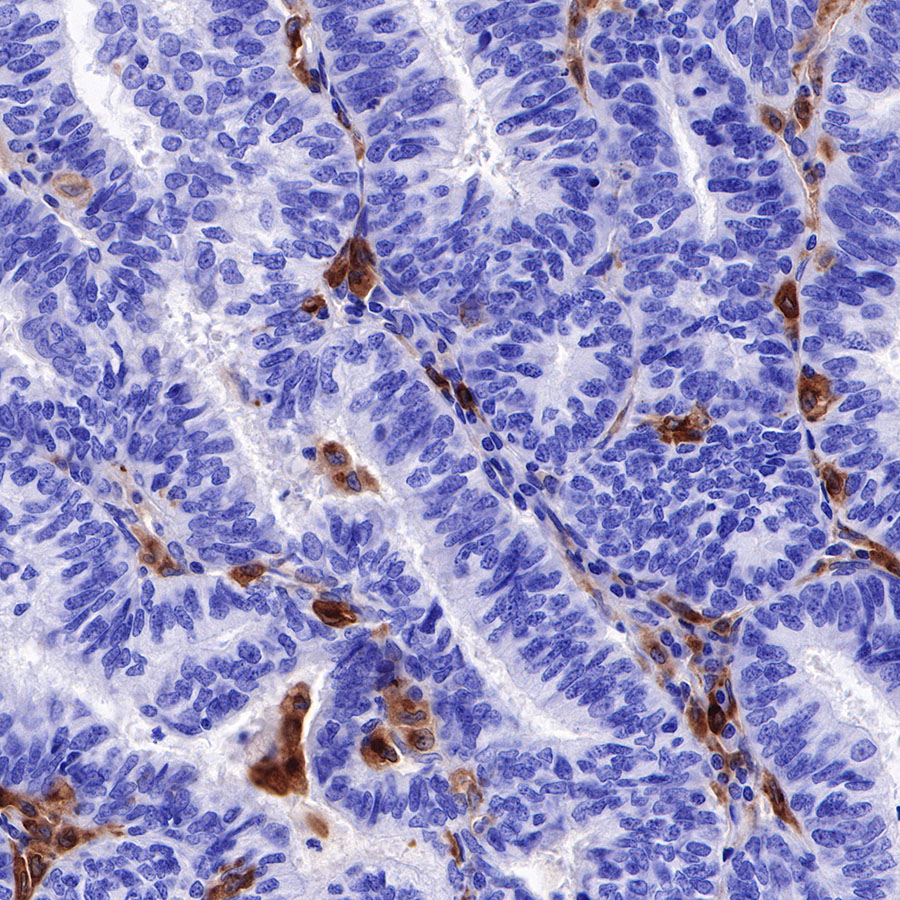 Rabbit anti-GPNMB Recombinant Monoclonal Antibody(S-R241)