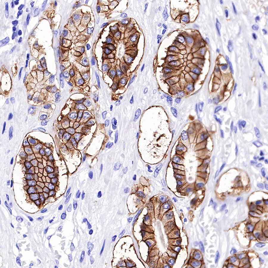 Rabbit anti-TACSTD2 Recombinant Monoclonal Antibody(S-R237)