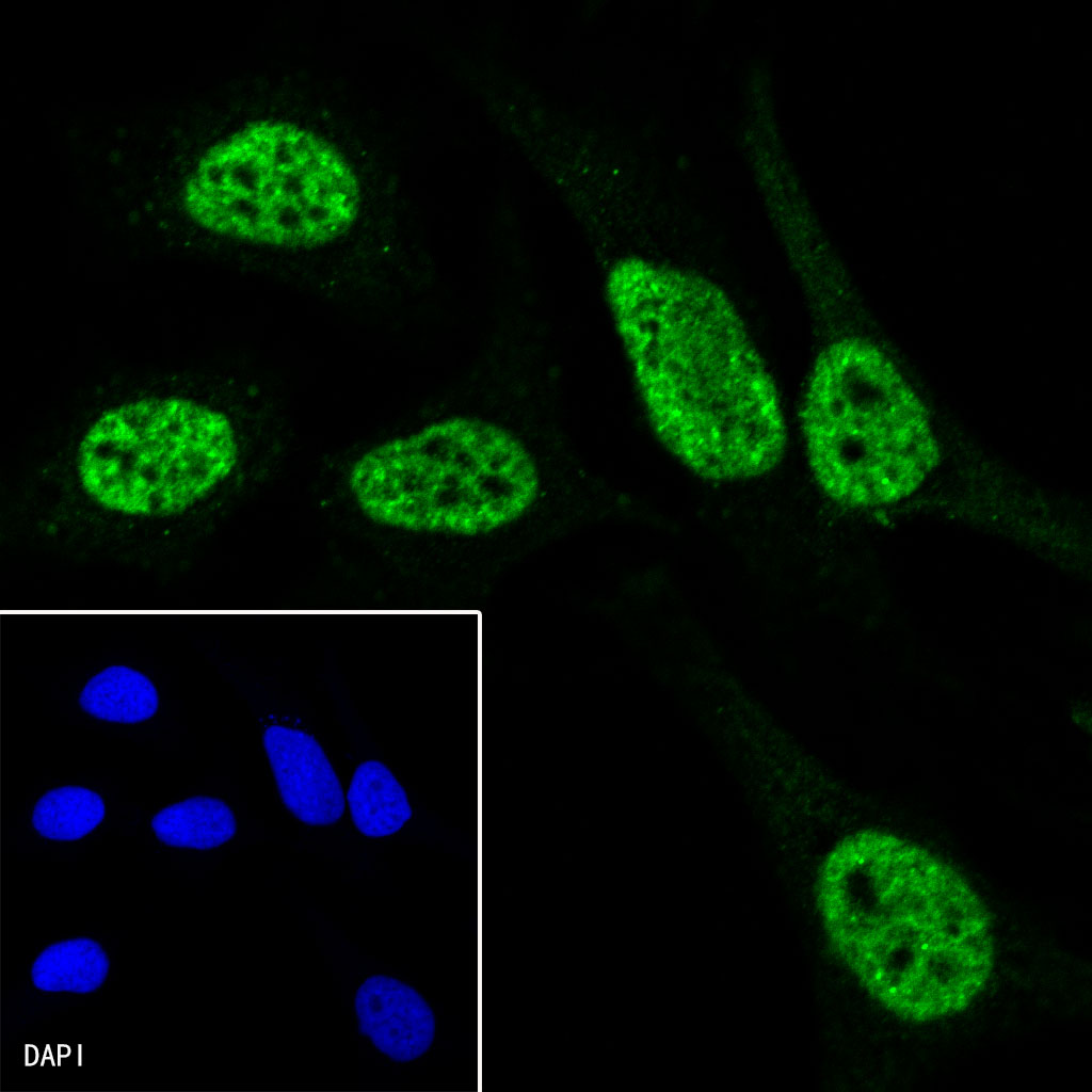Rat anti-Phospho-RNA Polymerase II CTD Repeat YSPTSPS(S7) Recombinant Monoclonal Antibody(S-R198)