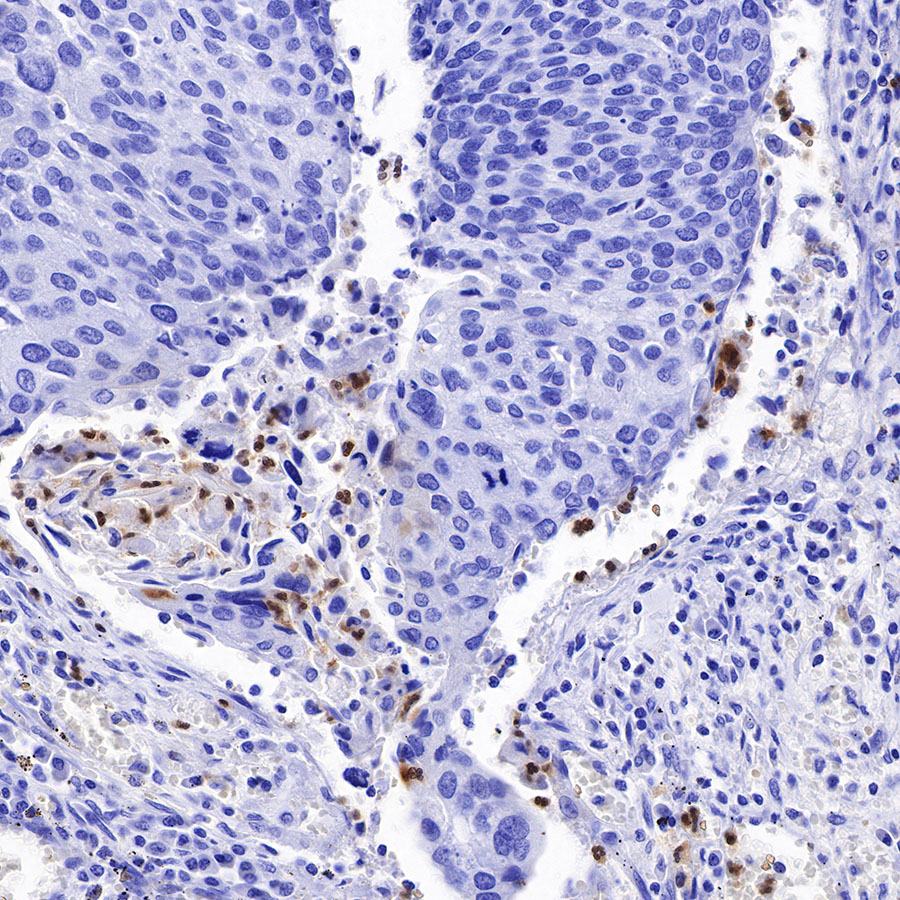 Rabbit anti-Arginase-1 Recombinant Monoclonal Antibody(369-33)