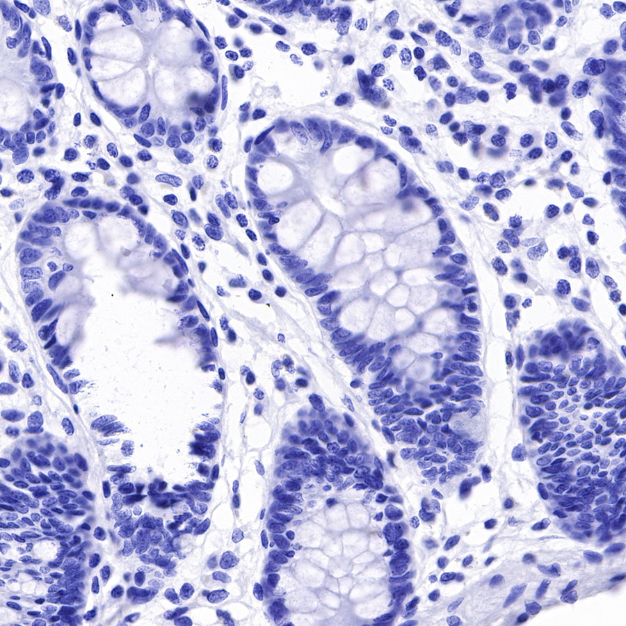 Rabbit anti-Arginase-1 Recombinant Monoclonal Antibody(369-33)