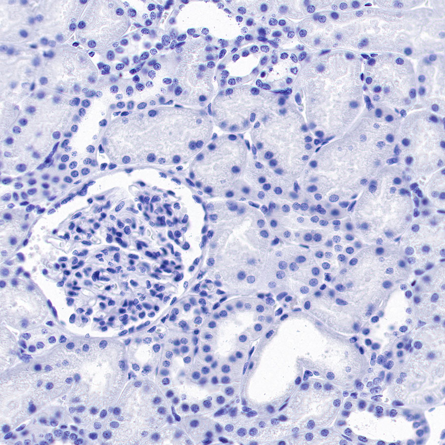 Rabbit anti-CA125 Recombinant Monoclonal Antibody(555-41)