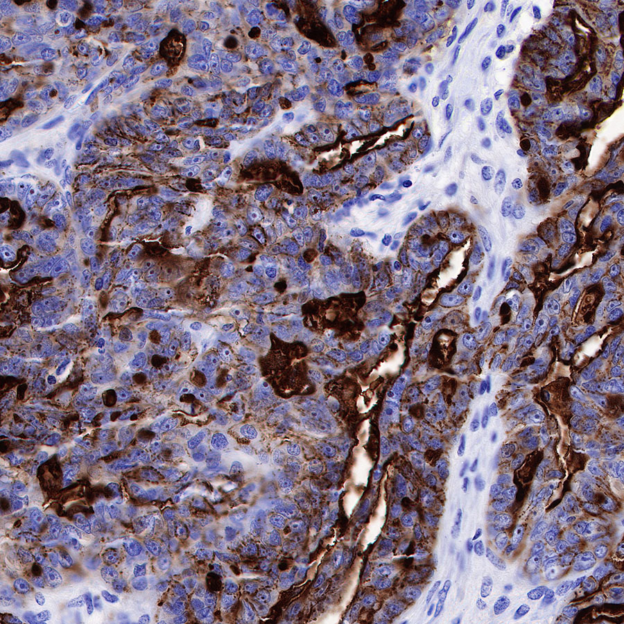 Rabbit anti-CA125 Recombinant Monoclonal Antibody(555-41)