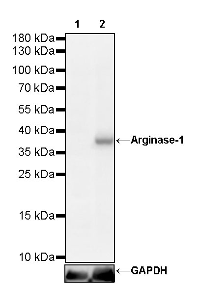 Rabbit anti-Arginase-1 Recombinant Monoclonal Antibody(369-33)