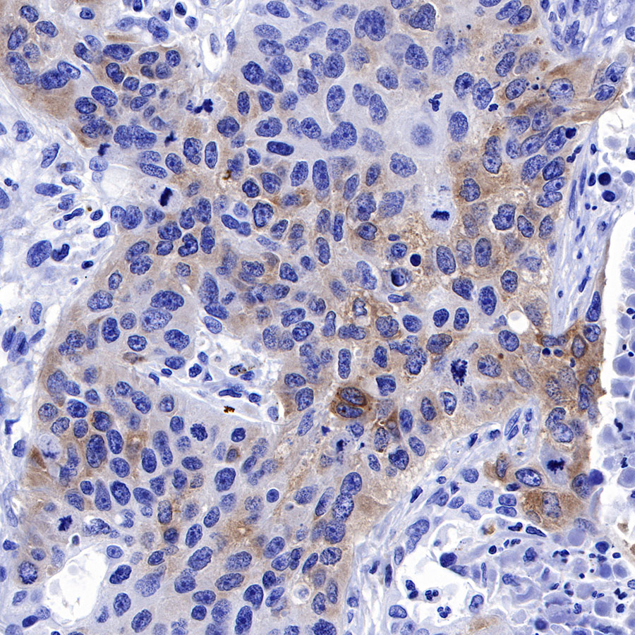 Rabbit anti-IMP-3 Recombinant Monoclonal Antibody(S-439-10)