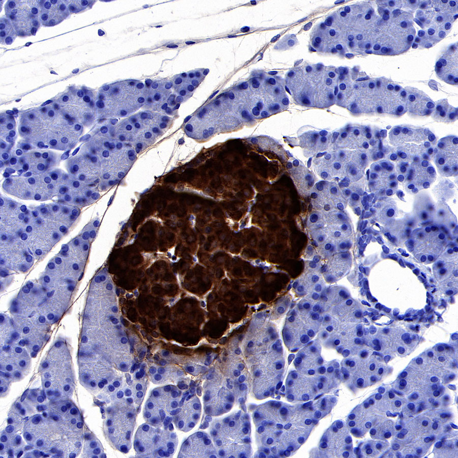 Rabbit anti-C-Peptide Recombinant Monoclonal Antibody(S-638-19)