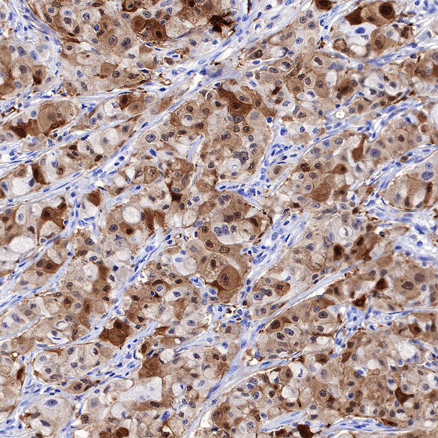 Rabbit anti-GST-π Recombinant Monoclonal Antibody(561-78)