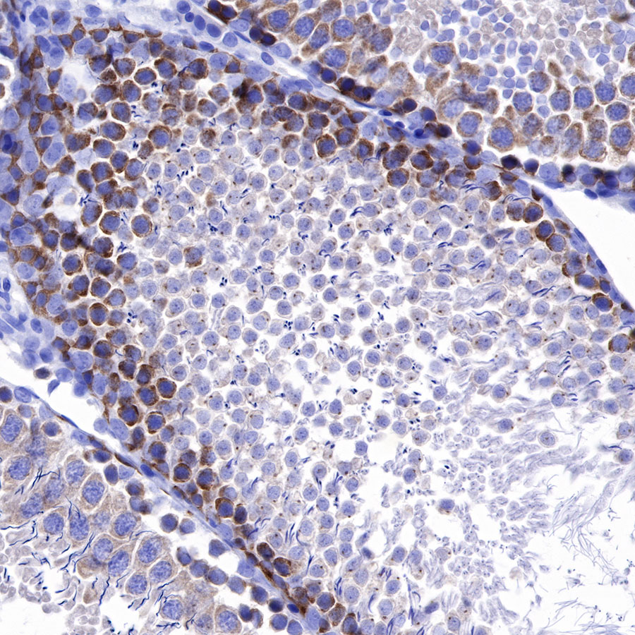 Rabbit anti-IMP-3 Recombinant Monoclonal Antibody(S-439-10)