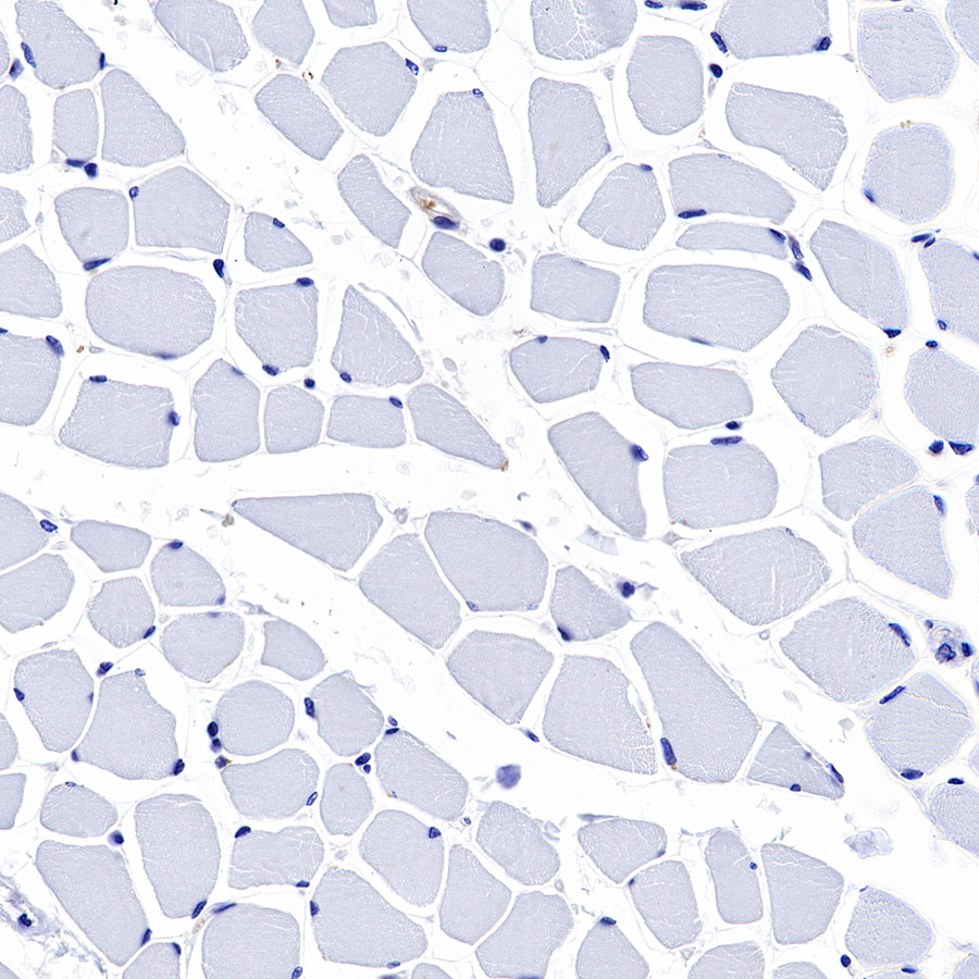 Rabbit anti-GST-π Recombinant Monoclonal Antibody(561-78)
