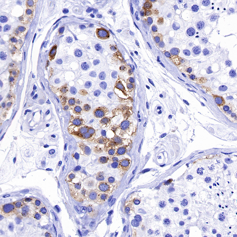 Rabbit anti-IMP-3 Recombinant Monoclonal Antibody(S-439-10)