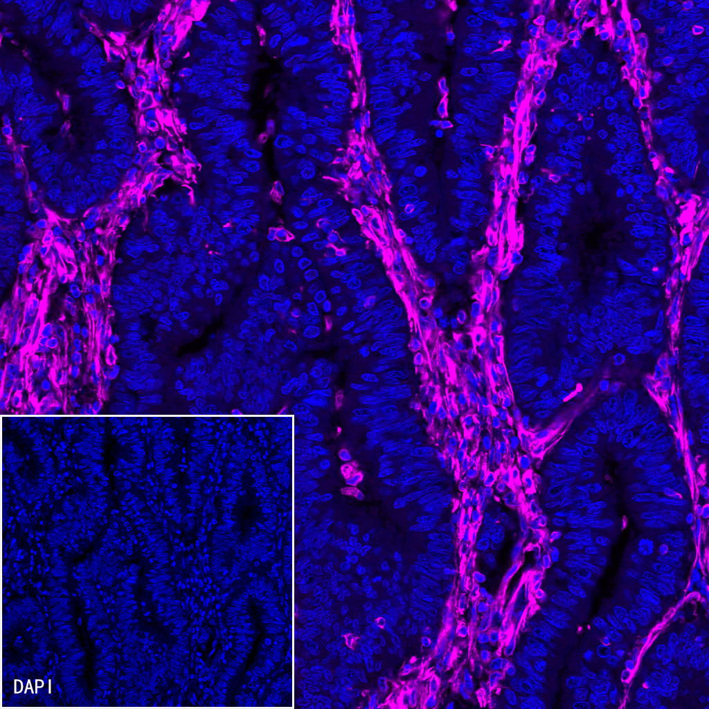 Rabbit anti-Vimentin Recombinant Monoclonal Antibody(AF647 Conjugate)(S-029-20)