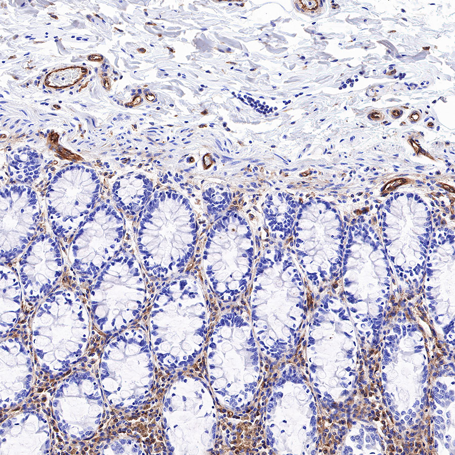 Rabbit anti-BST2 Recombinant Monoclonal Antibody(S-534-103)
