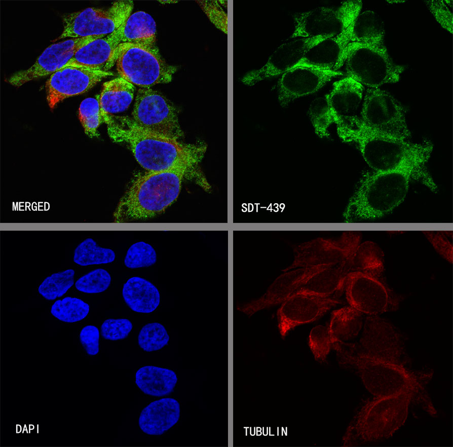 Rabbit anti-IMP-3 Recombinant Monoclonal Antibody(S-439-10)