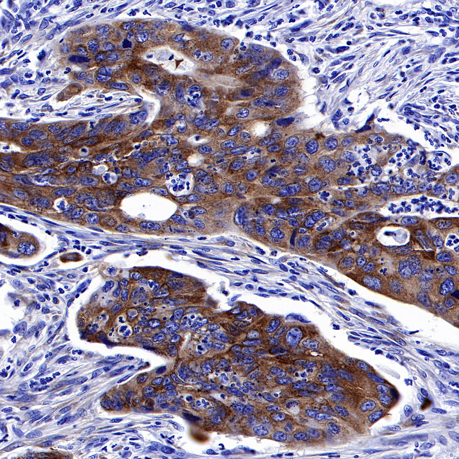 Rabbit anti-IMP-3 Recombinant Monoclonal Antibody(S-439-10)