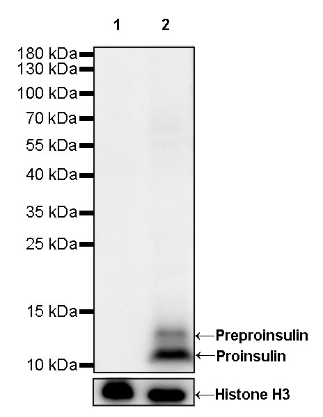 Rabbit anti-C-Peptide Recombinant Monoclonal Antibody(S-638-19)