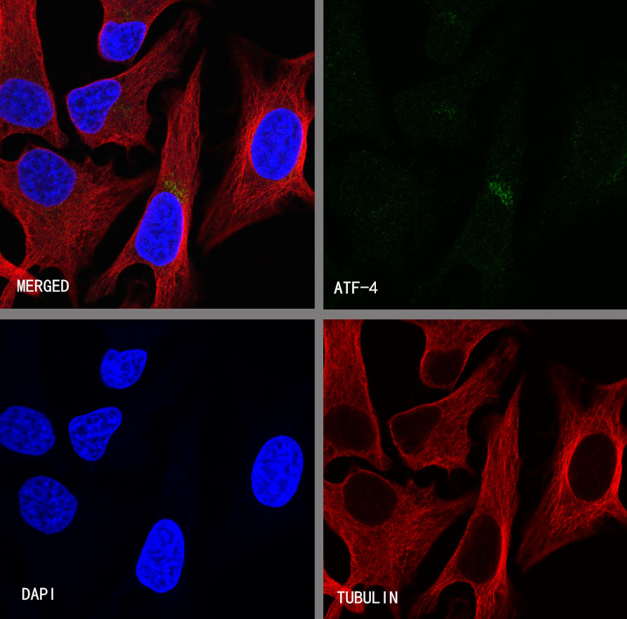 Rabbit anti-ATF-4 Recombinant Monoclonal Antibody(S-471-111)