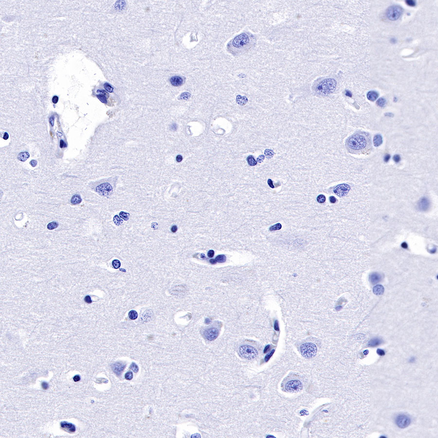 Rabbit anti-GLP-1(Active) Recombinant Monoclonal Antibody(S-R280)
