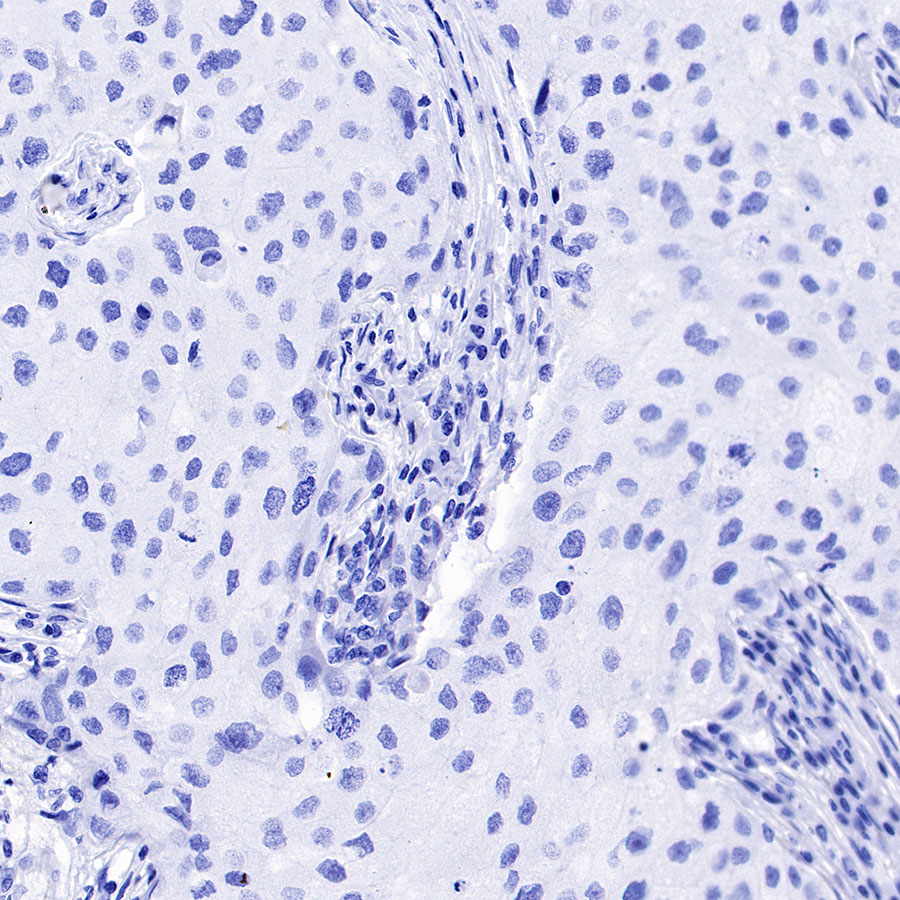 Rabbit anti-GLP-1(Active) Recombinant Monoclonal Antibody(S-R280)