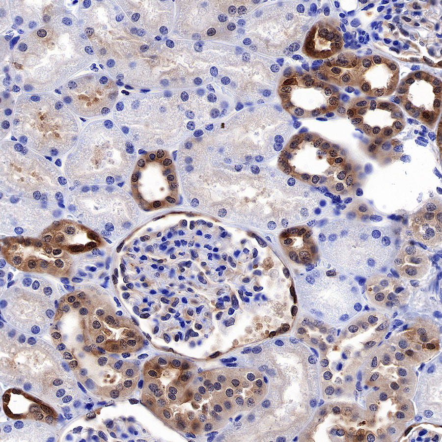 Rabbit anti-GST-π Recombinant Monoclonal Antibody(561-78)