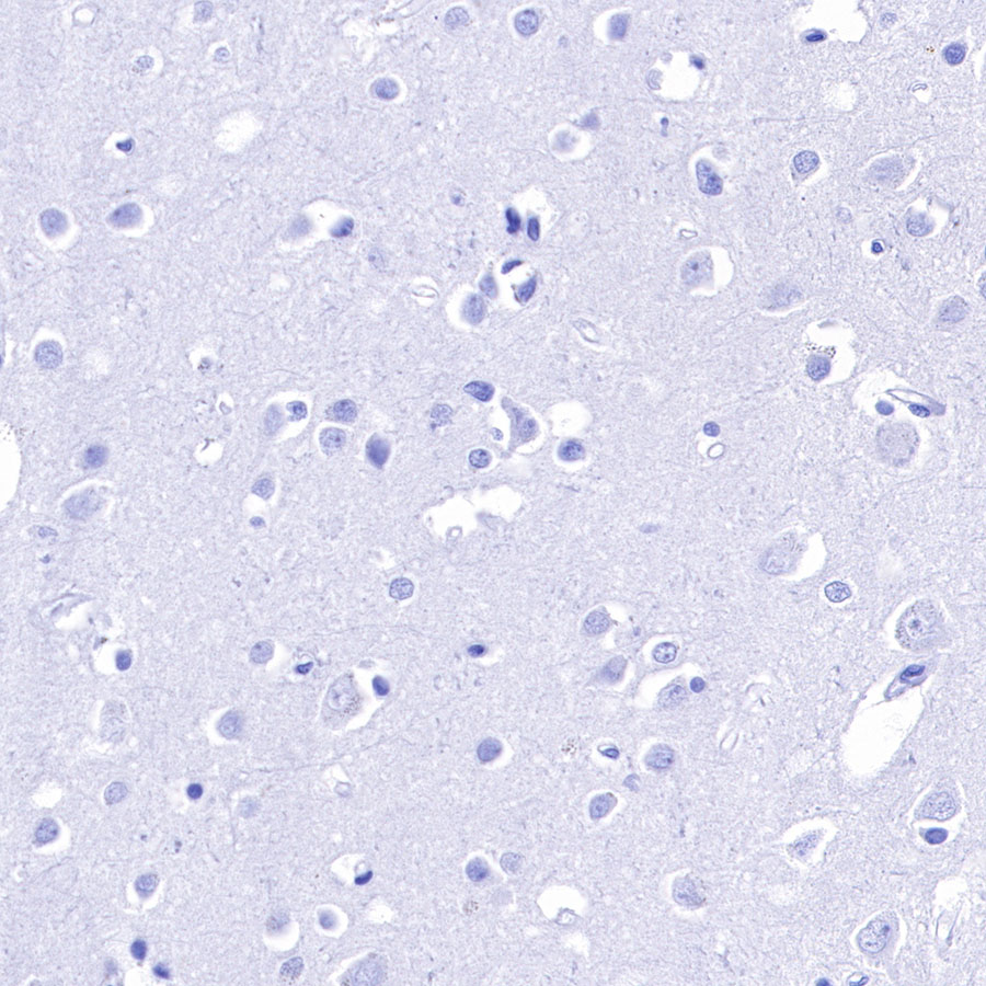 Rabbit anti-IMP-3 Recombinant Monoclonal Antibody(S-439-10)