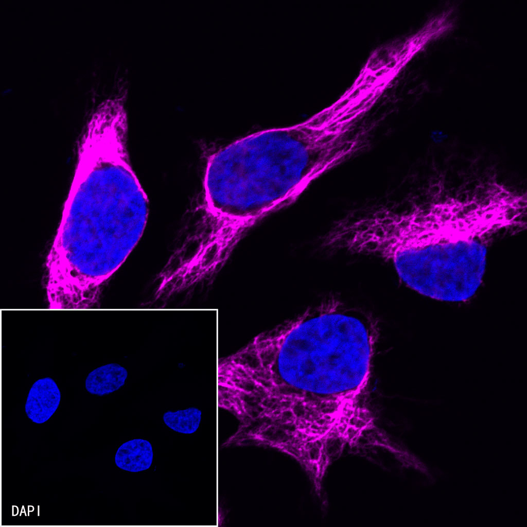Rabbit anti-Vimentin Recombinant Monoclonal Antibody(AF647 Conjugate)(S-029-20)