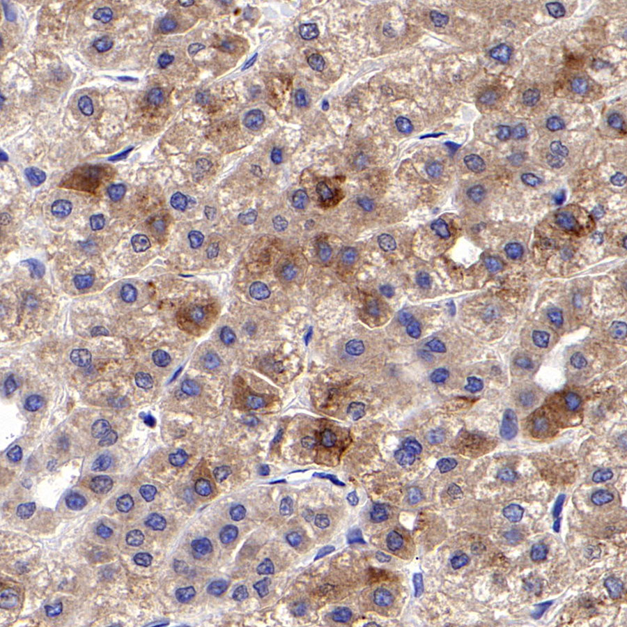 Rabbit anti-CHI3L1 Recombinant Monoclonal Antibody(S-324-38)