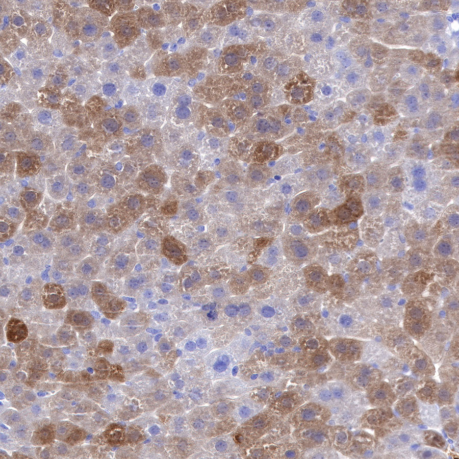 Rabbit anti-GST-π Recombinant Monoclonal Antibody(561-78)