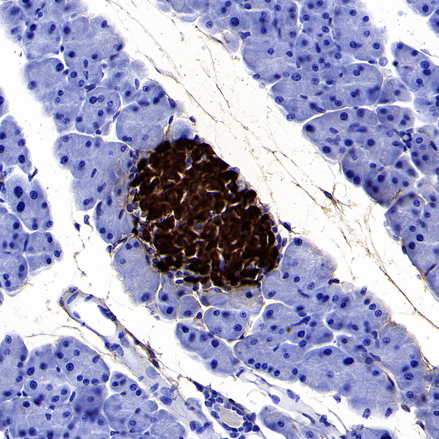 Rabbit anti-C-Peptide Recombinant Monoclonal Antibody(S-638-19)