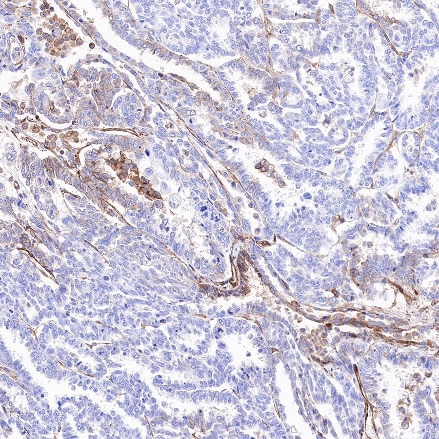 Rabbit anti-BST2 Recombinant Monoclonal Antibody(S-534-103)