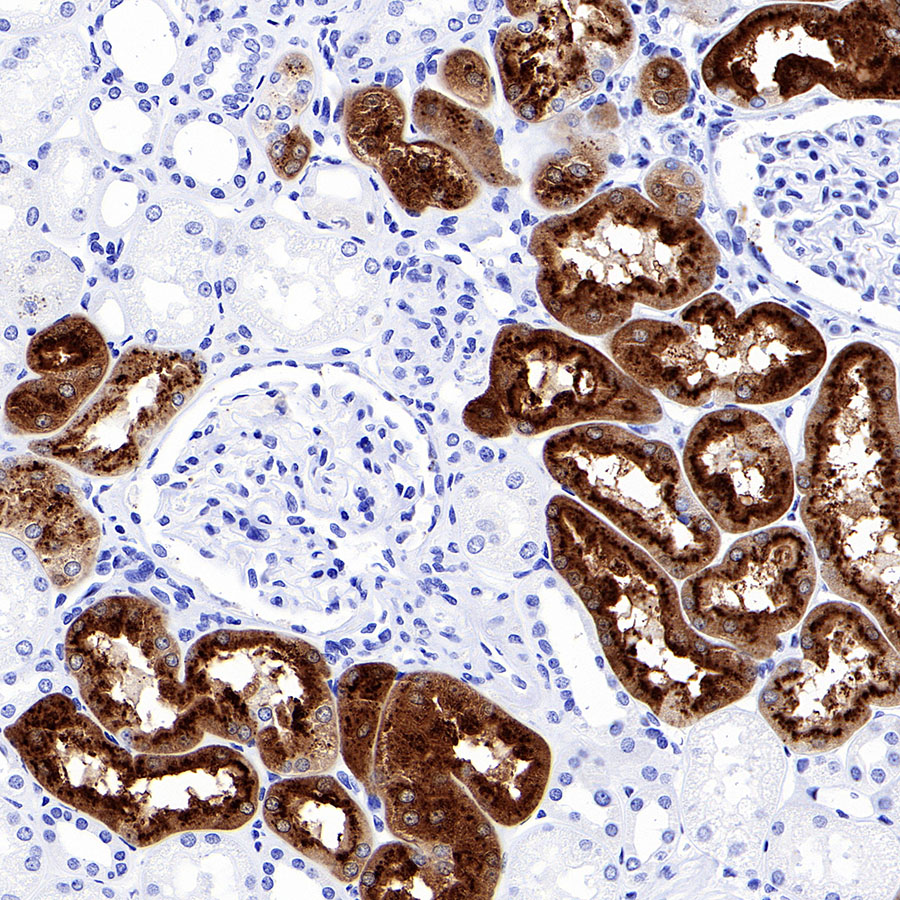 Rabbit anti-CHI3L1 Recombinant Monoclonal Antibody(S-324-38)