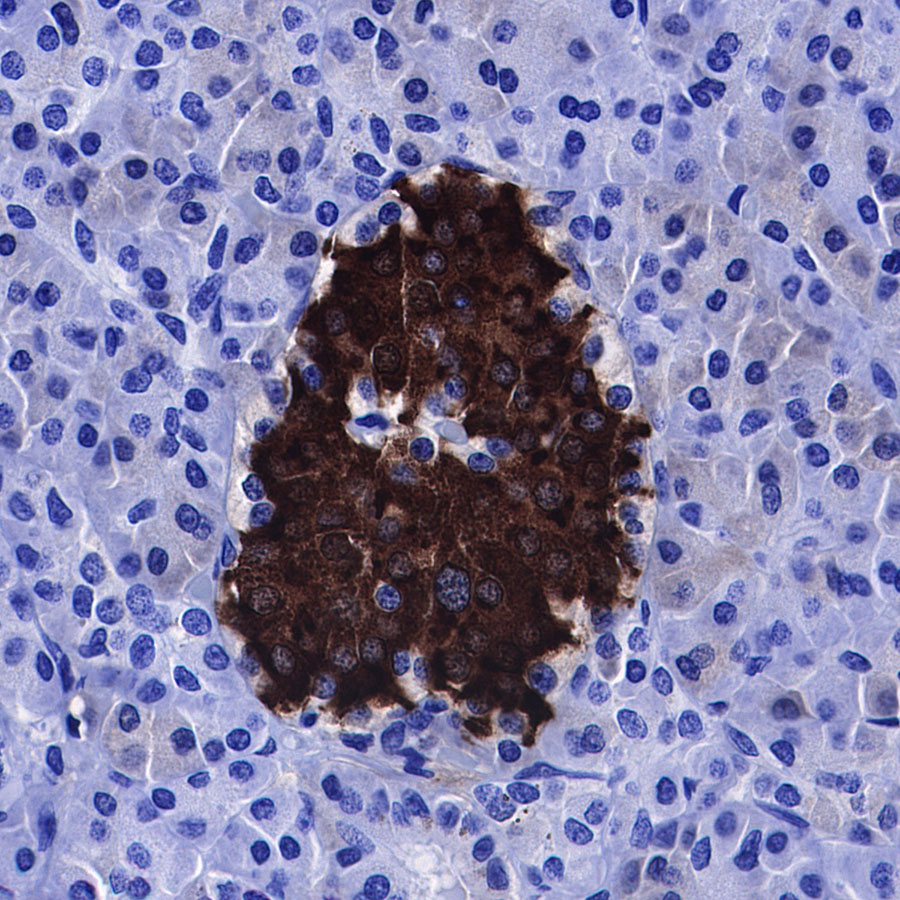 Rabbit anti-C-Peptide Recombinant Monoclonal Antibody(S-638-19)