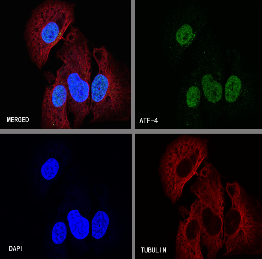 Rabbit anti-ATF-4 Recombinant Monoclonal Antibody(S-471-111)