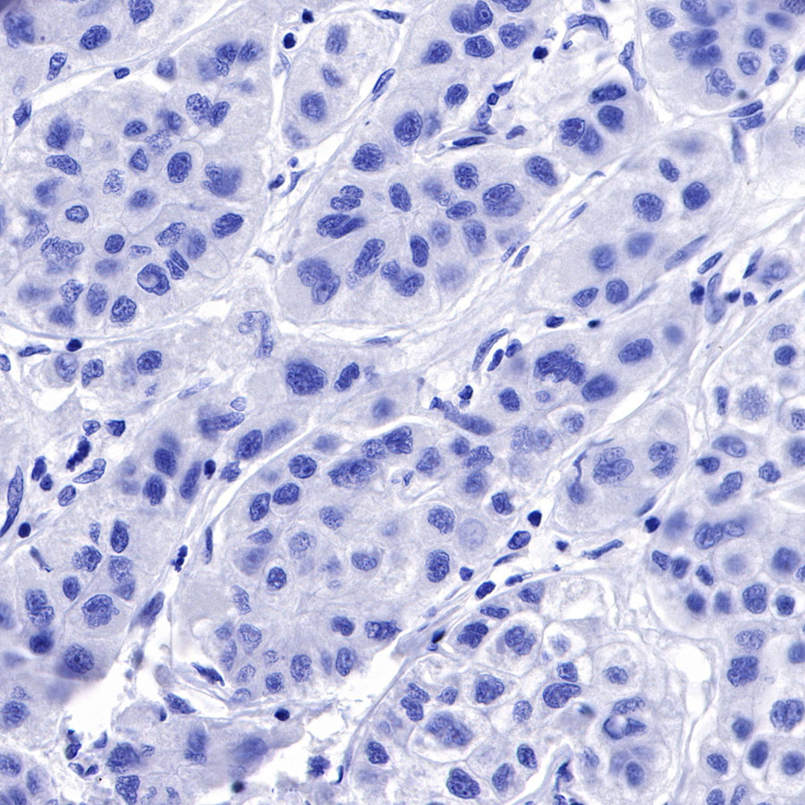 Rabbit anti-IMP-3 Recombinant Monoclonal Antibody(S-439-10)