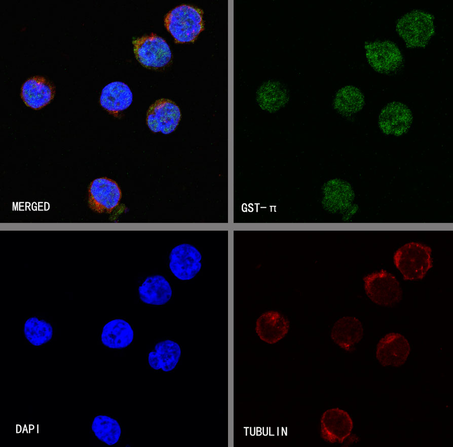 Rabbit anti-GST-π Recombinant Monoclonal Antibody(561-78)