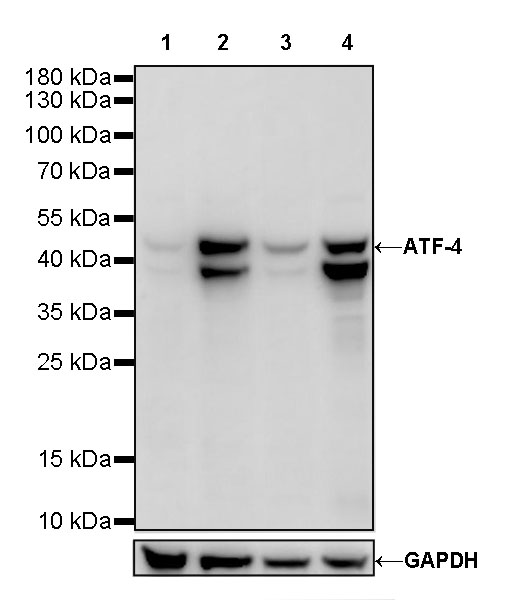 Rabbit anti-ATF-4 Recombinant Monoclonal Antibody(S-471-111)