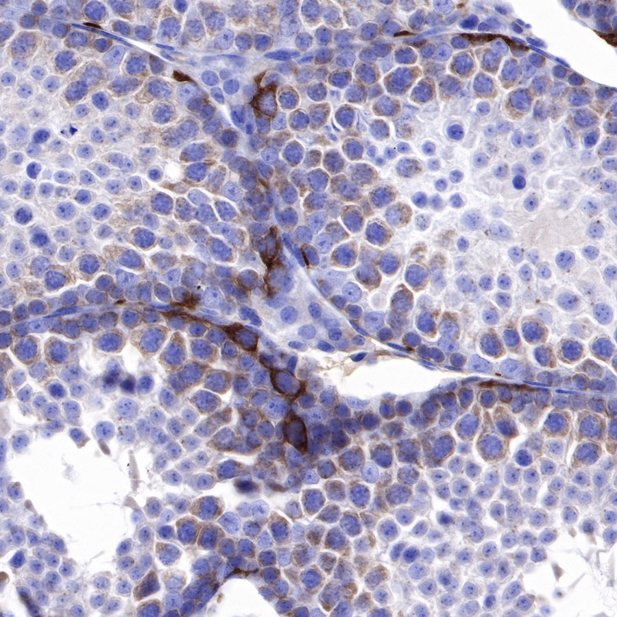 Rabbit anti-IMP-3 Recombinant Monoclonal Antibody(S-439-10)
