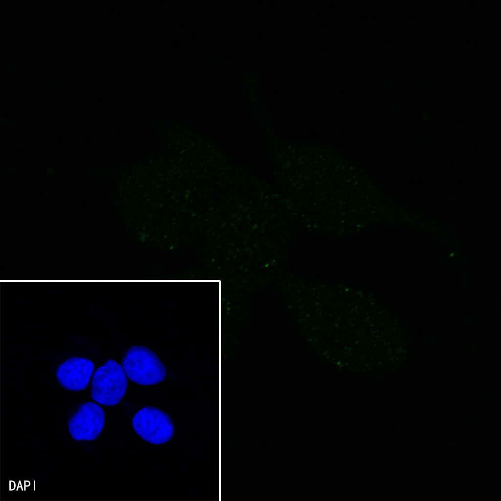 Rabbit anti-CHI3L1 Recombinant Monoclonal Antibody(S-324-38)