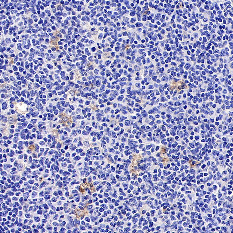 Rabbit anti-CHI3L1 Recombinant Monoclonal Antibody(S-324-38)
