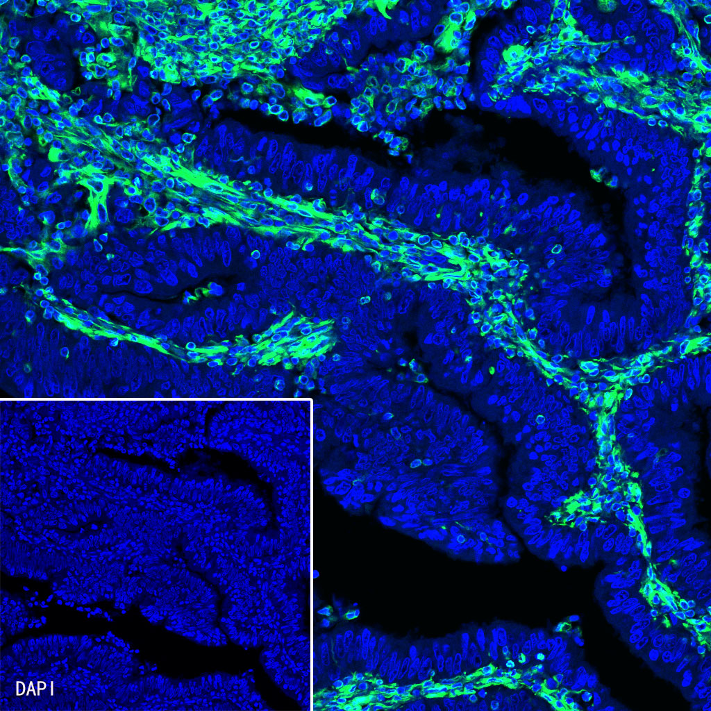 Rabbit anti-Vimentin Recombinant Monoclonal Antibody(AF488 Conjugate)(S-029-20)