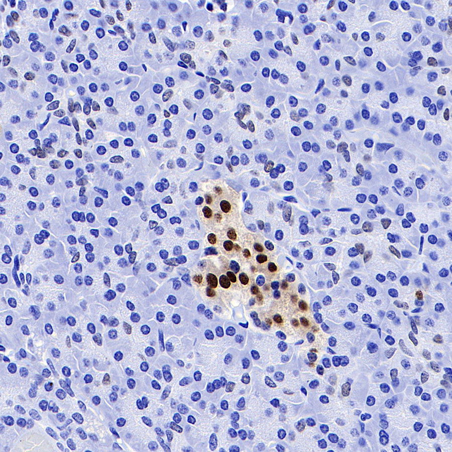 Rabbit anti-NKX6.1 Recombinant Monoclonal Antibody(S-260-31)