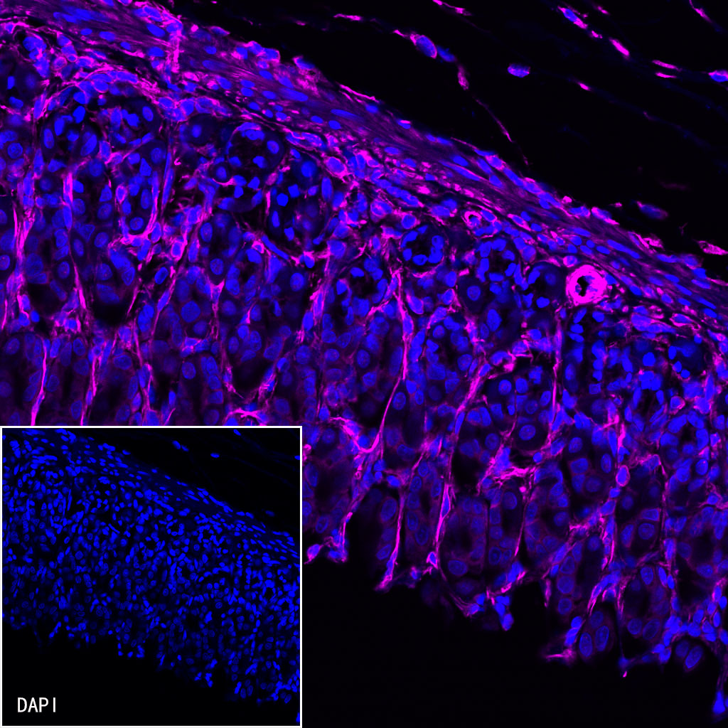 Rabbit anti-Vimentin Recombinant Monoclonal Antibody(AF647 Conjugate)(S-029-20)
