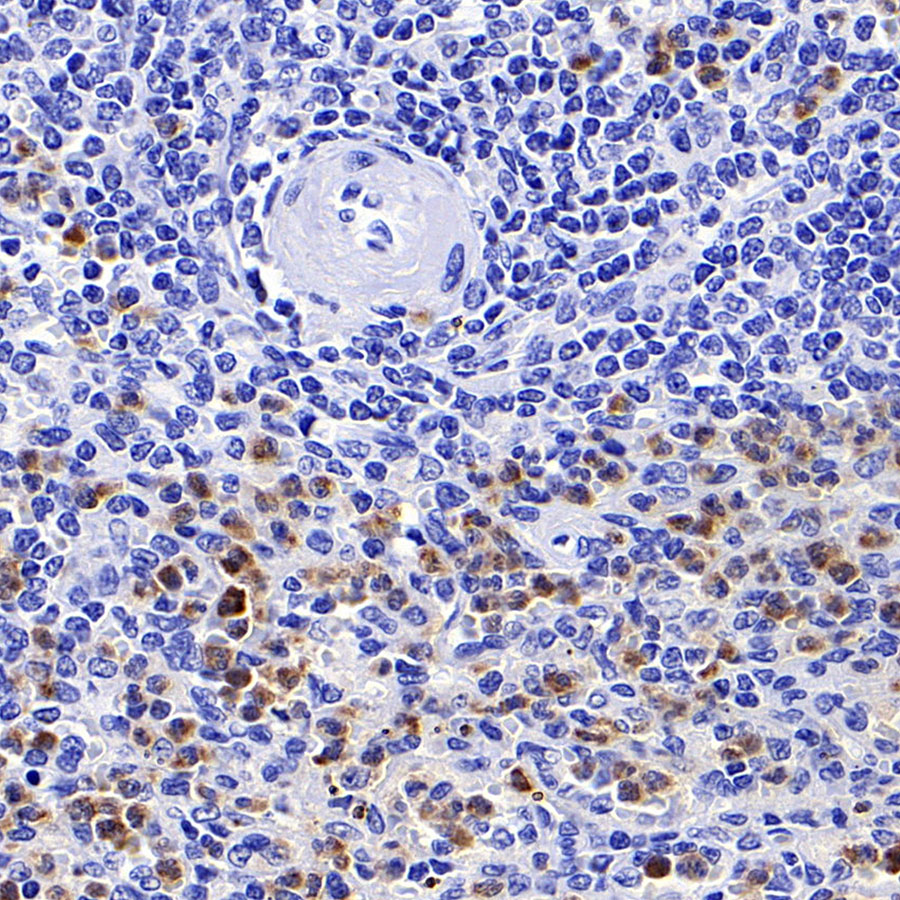 Rabbit anti-CHI3L1 Recombinant Monoclonal Antibody(S-324-38)